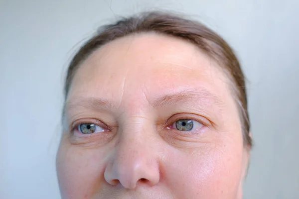 妇女脸部上部 老年妇女近视 大小仿皱纹 有斑点的眼睛 视力差的概念 眼睛疲劳 眼睑下垂 皮肤老化弹性矫正 — 图库照片