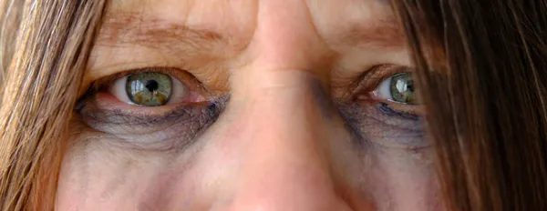 Close Dari Perempuan Bernoda Air Mata Wajah Wanita Dipukuli Dengan — Stok Foto