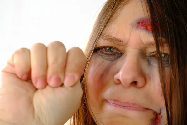 Close Van Een Vrouwelijke Hand Het Concept Van Huiselijk Geweld — Stockfoto