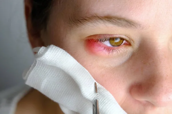 Dentist Medic Vindecă Durerea Ochiul Bolnav Pacientului Sex Feminin Partea — Fotografie, imagine de stoc