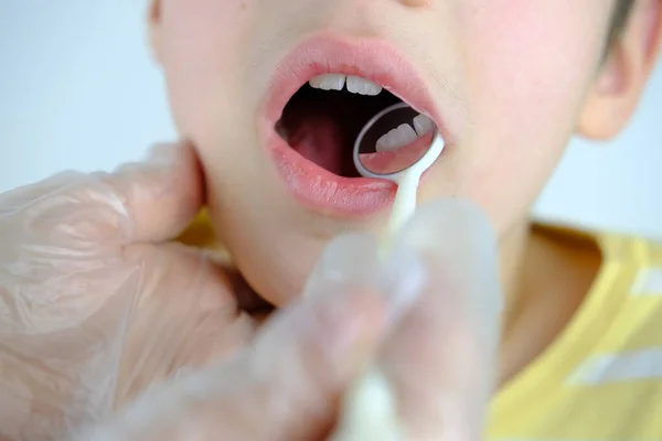 Dentista Médico Examina Cavidade Oral Pequeno Paciente Masculino Usa Espelho — Fotografia de Stock