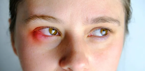 Hasarlı Hasta Bir Kadının Gözlerini Iyileştirir Yüzünün Bir Kısmını Kapatır — Stok fotoğraf