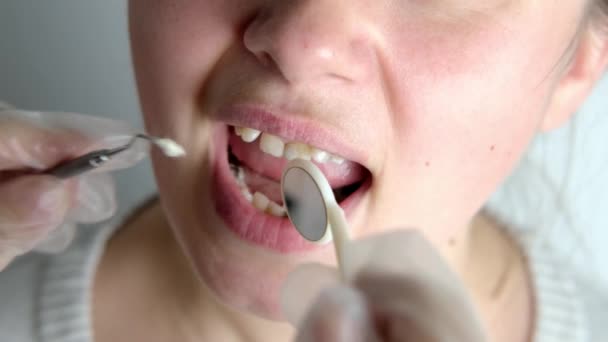 Dentist Doctor Heals Teeth Female Patient Uses Mouth Mirror Closeup — Stock Video