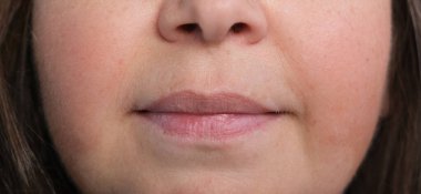 45-50 yaşlarında orta yaşlı bir kadının yüzünün bir kısmı, cildinde, dudaklarında küçük kırışıklıklar, yaşlanma karşıtı prosedürler, estetik ameliyatlardan önce yüz masajı,