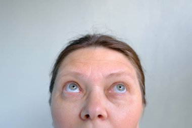 Kadının yüzünün üst kısmı, yaşlı kadın yakın plan, küçük ve büyük taklit kırışıklıklar, benekli gözler, saçlardaki alopecia konsepti, yaşlanmayı önleyen cilt esnekliğinin düzeltilmesi, yaşlanma karşıtı tedaviler.