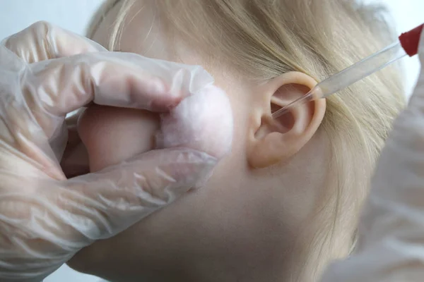 close-up of ear of small child, doctor treats otitis media, concept of hearing organs health, happy childhood, prevention of otitis media and hearing loss, World Hearing Day
