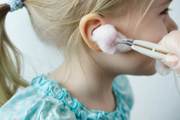 幼儿耳朵近视 医生治疗中耳炎 听力器官健康概念 快乐童年 预防中耳炎和听力损失 世界听力日 — 图库照片