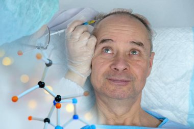 Yakın plan trikoloğu saç büyütme kliniğinde saç dökülmesi olan kel ve olgun bir adamı ve kelleşen erkekler için yaşlanma karşıtı tedavileri tedavi ediyor. Erkekler için saç nakli prosedürleri konsepti, seçici odaklanma