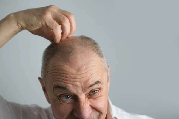 Close Oude Kale Charismatische Volwassen Man Toont Zijn Haar Vallen — Stockfoto