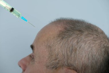 Yetişkin karizmatik bir adamın yakın çekimi, son 60 yıl mavi hastane elbisesi içinde cilt sağlığı ve güzellik kliniğinde yatıyor, doktorun elleri hastaya iğne yapıyor, kozmetik yaşlanmayı önleme prosedürleri konsepti