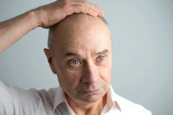 Close Old Bald Charismatic Mature Man Showing His Hair Fall — Stock Photo, Image