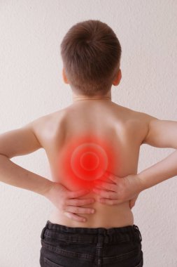 Çocuğun çıplak sırtı, 8-10 yaşlarında bir çocuk, omurga kıvrımlı, omurgadaki ağrının sembolü kırmızı nokta, osteokondroz, skolyoz, sırt ağrısı, omurgalar arası fıtık,