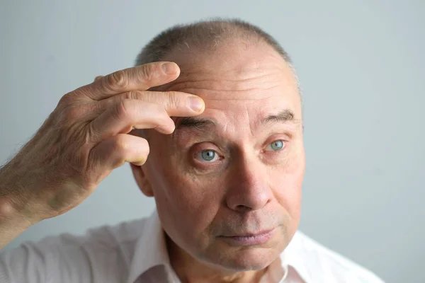 Close Face Bald Mature Man Years Old Looks Mirror Critically — Stock Photo, Image