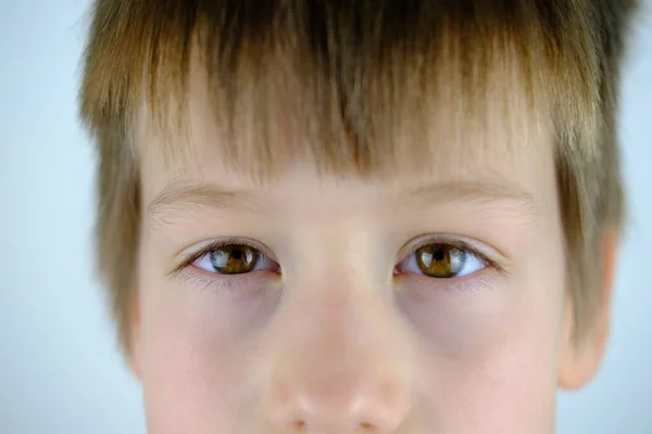 Close Part Child Face Serious Look Brown Eyes Anxious Face — Foto de Stock