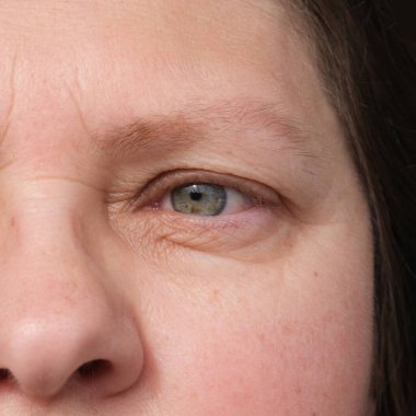 close up part of mature woman 50 years face, girl 20-29 years old, human eye, small wrinkles around eyes, overhang, concept of surveillance, vision examination, cosmetic anti-aging procedures
