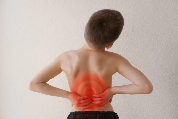 Naked Back Boy Child Years Old Grabbed Sore Spot Curved — Stock Photo, Image