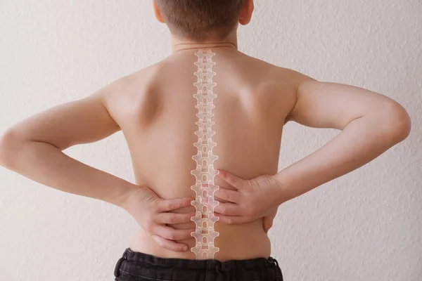 Yaşlarında Çıplak Bir Çocuk Omurgasında Ağrı Omurga Ağrısı Osteokondrosis Skolyoz — Stok fotoğraf