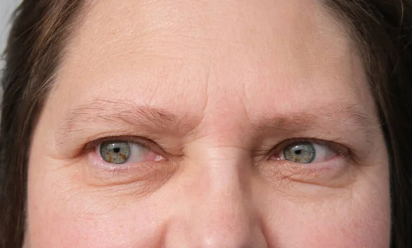 近半身成熟妇女面容 29岁女孩 眼部周围小皱纹 监视观念 视力检查 化妆品抗衰老程序 — 图库照片