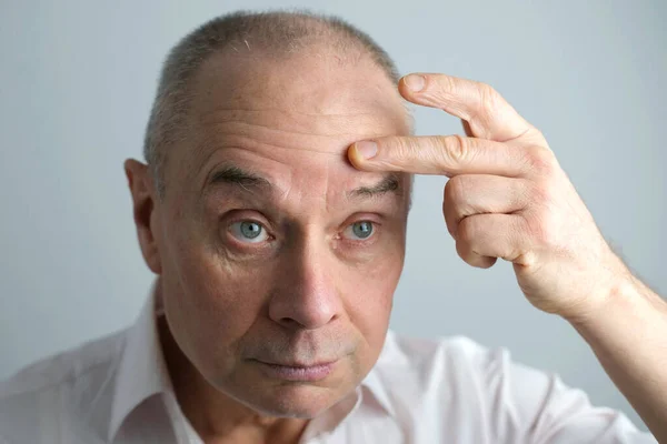 Close Face Bald Mature Man Years Old Looks Mirror Critically — Stock Photo, Image