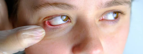 Ofthalmologist Dokter Menyembuhkan Luka Sakit Mata Pasien Perempuan Menutup Bagian — Stok Foto