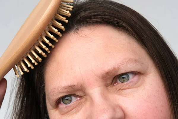 Close Mature Adult Woman Brushing Her Hair Combing Dirty Greasy — Stock Photo, Image