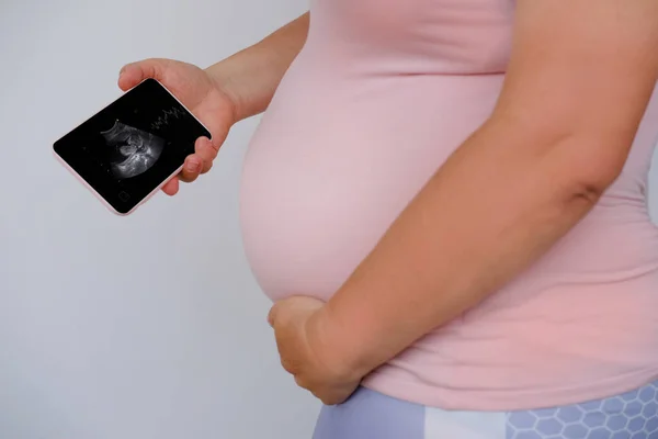 pregnant woman holds mobile phone with ultrasound screen examination, small child rolls over in mother's belly, concept pregnancy reproduction, healthcare pregnancy, happy motherhood, selective focus
