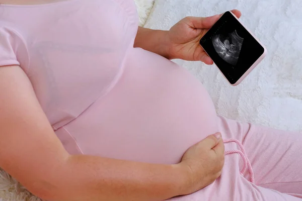 pregnant woman holds mobile phone with ultrasound screen examination, small child rolls over in mother\'s belly, concept pregnancy reproduction, healthcare pregnancy, happy motherhood, selective focus