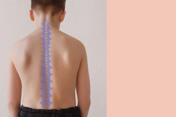 part of naked back of boy, child 8-10 years old is standing, good posture, straight back, prevention of scoliosis in childhood, health, strengthening of the spine