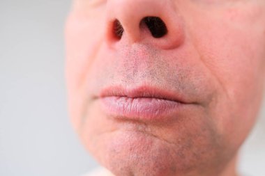 Yüzünde güçlü kırışıklıklar, parlak duygular ve erkek cilt bakımı kavramı olan altmışlı yaşlardaki beyaz bir adamın ön yüzü.