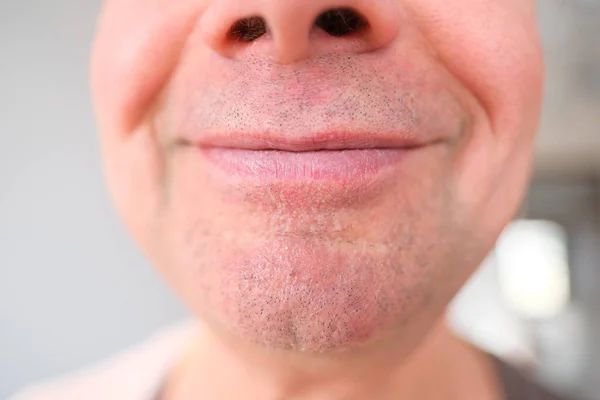 Close Front View Mouth Old Caucasian Man His Sixties Strong — Stock Photo, Image
