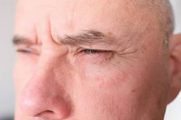 Close Front View Narrowed Eye Old Caucasian Man His Sixties — Stok Foto