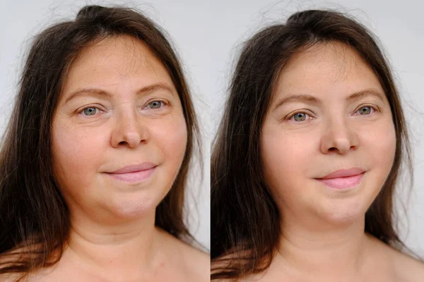 整容手术前后 女性面部特写 50岁妇女颈部有两种皱纹 面部皱纹 化妆品抗衰老程序 — 图库照片