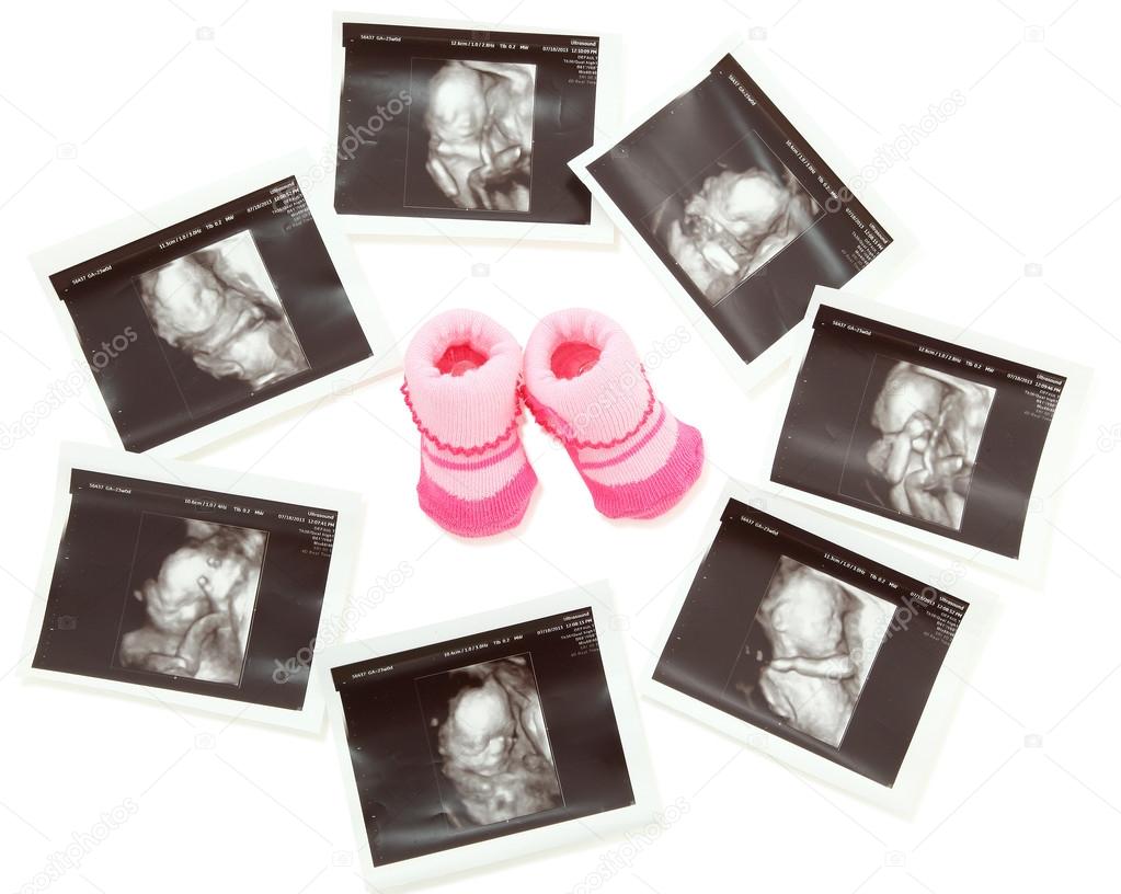 Group of 3D 4D Ultrasound images around a pair of pink baby boot