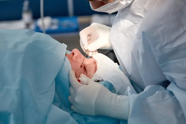 Close up da face de um paciente que está sendo submetido a blefaroplastia. O cirurgião corta a pálpebra e realiza manipulações usando instrumentos médicos — Fotografia de Stock