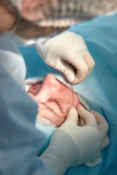 Primer plano de la cara de un paciente que se somete a una blefaroplastia. El cirujano corta el párpado y realiza manipulaciones utilizando instrumentos médicos —  Fotos de Stock