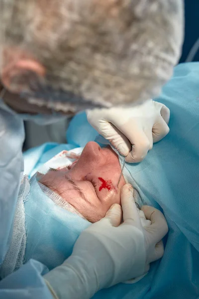 Detailní záběr obličeje pacienta, který podstupuje blefaroplastiku. Chirurg uřízne víčko a provádí manipulaci pomocí lékařských nástrojů — Stock fotografie
