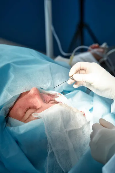 Close up da face de um paciente que está sendo submetido a blefaroplastia. O cirurgião corta a pálpebra e realiza manipulações usando instrumentos médicos — Fotografia de Stock