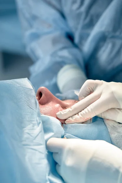 Close up da face de um paciente que está sendo submetido a blefaroplastia. O cirurgião corta a pálpebra e realiza manipulações usando instrumentos médicos — Fotografia de Stock