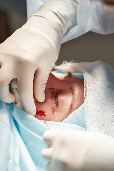 Primer plano de la cara de un paciente que se somete a una blefaroplastia. El cirujano corta el párpado y realiza manipulaciones utilizando instrumentos médicos —  Fotos de Stock