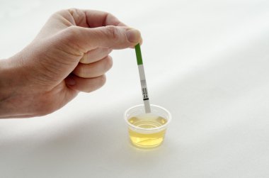 Ovulation test clipart