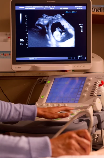 Ultrasound scanning — Stock Photo, Image