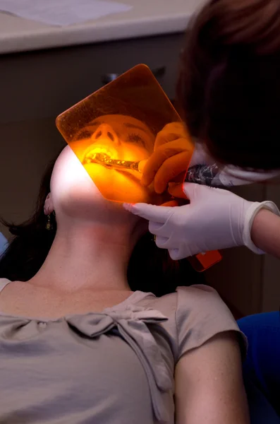 Exame dos dentes — Fotografia de Stock