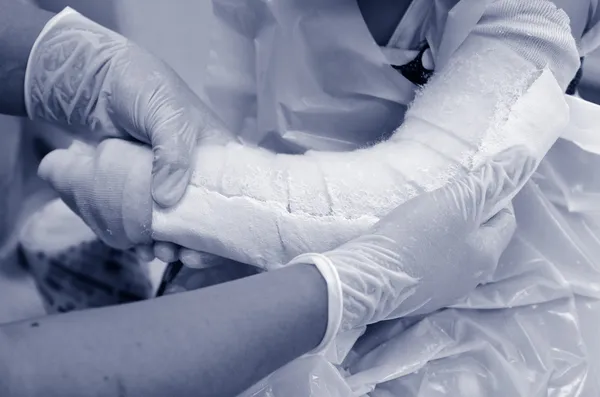 Child with a broken arm — Stock Photo, Image