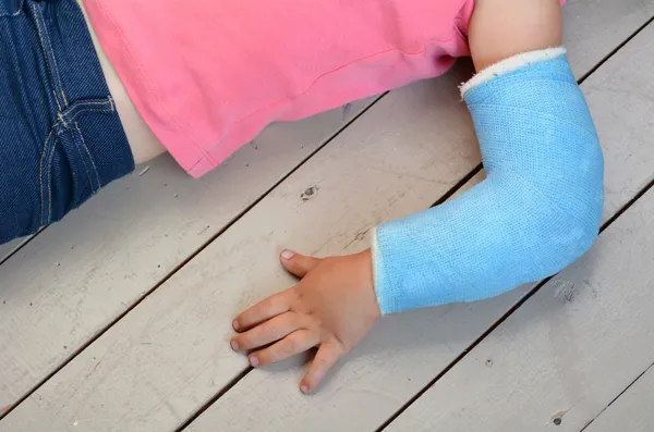 Niño con brazo fundido — Foto de Stock