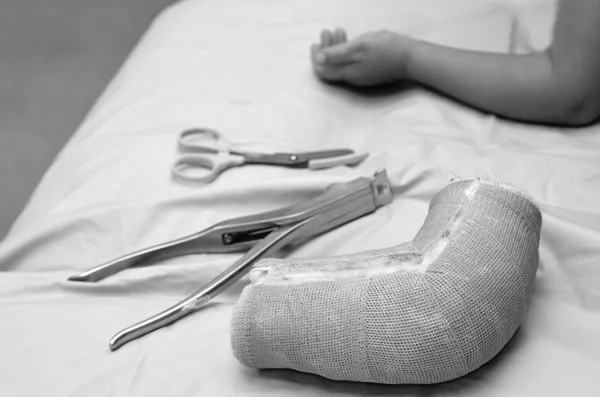 Kind mit Gips am Arm — Stockfoto