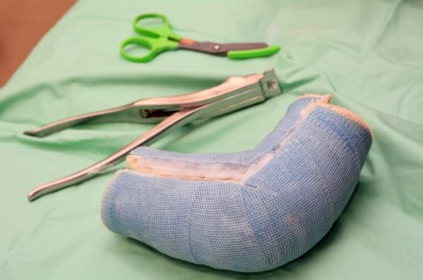 Child with arm cast — Stock Photo, Image