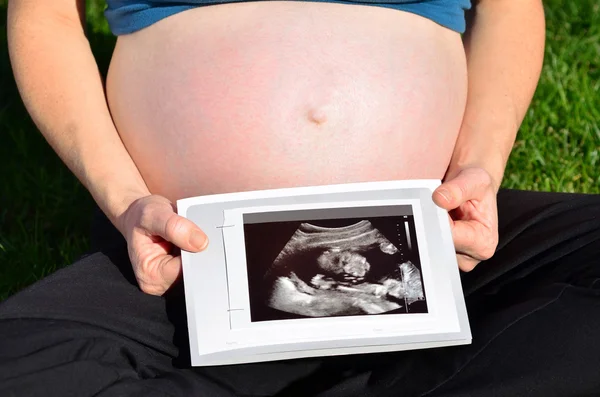 Zwangere vrouw met echo scan — Stockfoto