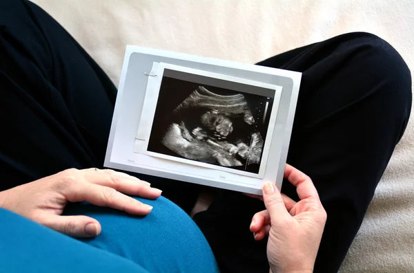 Pregnant woman with ultrasound scan — Stock Photo, Image