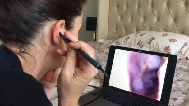 Mulher Adulta Usando Limpador Ouvido Visual Endoscópio Olhando Para Monitor — Vídeo de Stock