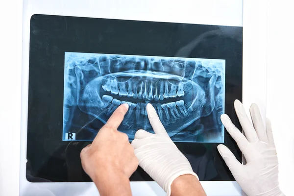 Examining teeth X Ray — Stock Photo, Image